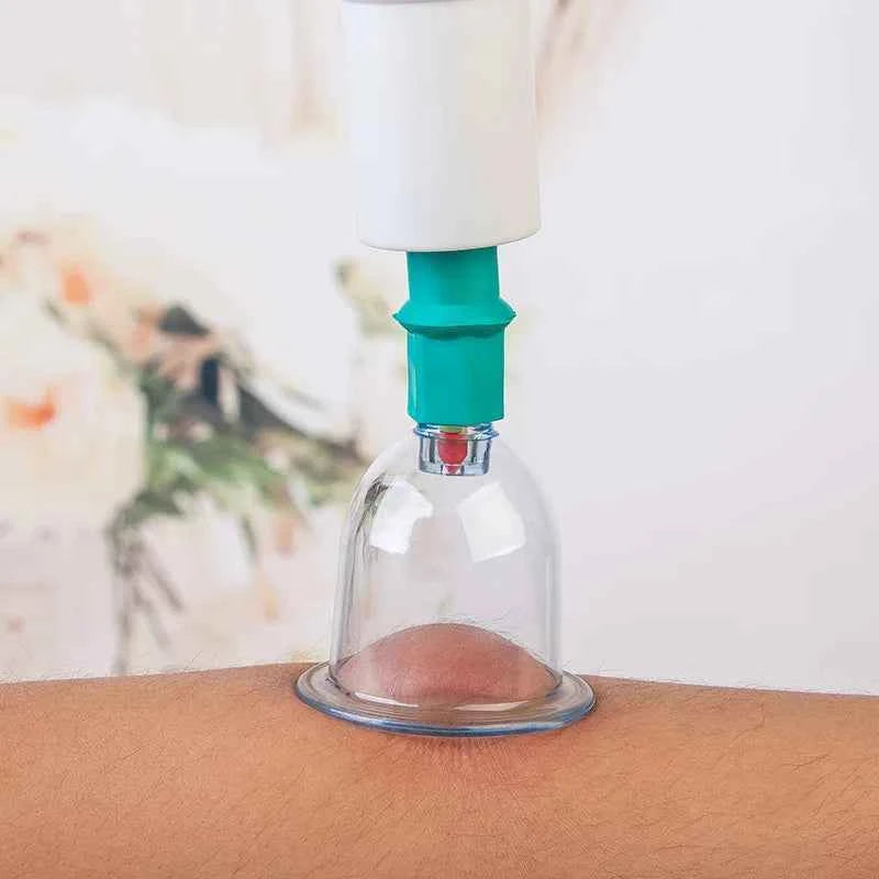 SET HIJAMA ESSENTIEL — 6 Ventouses + Pompe Pro - MoonRose by Amour’Eu