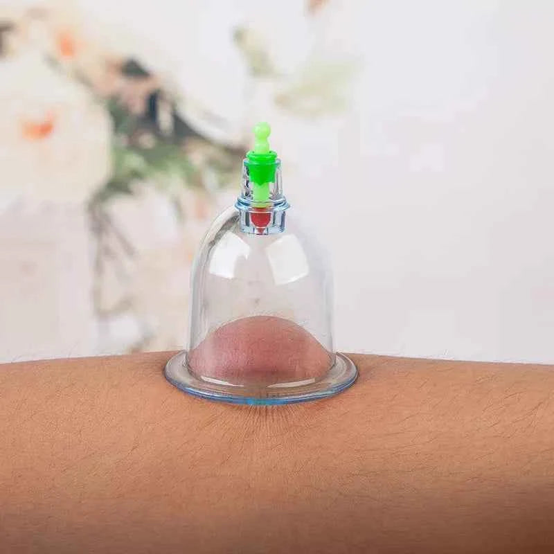 SET HIJAMA ESSENTIEL — 6 Ventouses + Pompe Pro - MoonRose by Amour’Eu