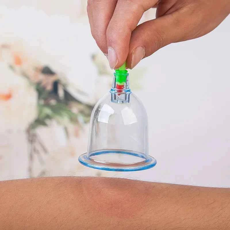 SET HIJAMA ESSENTIEL — 6 Ventouses + Pompe Pro - MoonRose by Amour’Eu