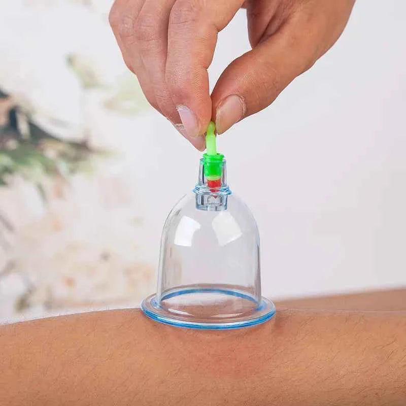 SET HIJAMA ESSENTIEL — 6 Ventouses + Pompe Pro - MoonRose by Amour’Eu